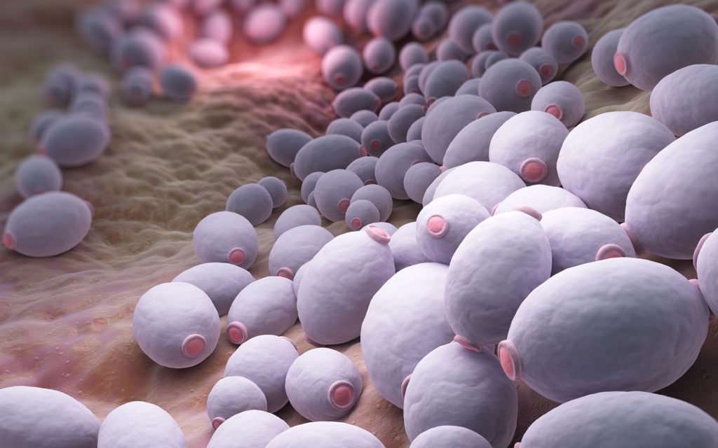 Candidiasis crónica intestinal