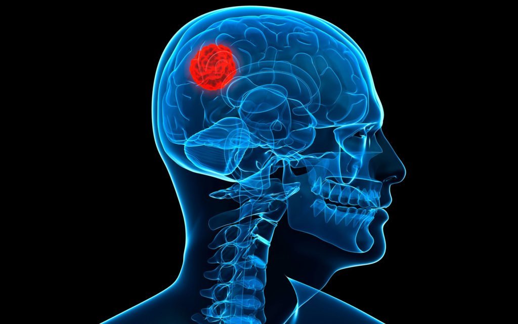 Medidas para reducir el riesgo de tumores cerebrales por el empleo de teléfonos celulares